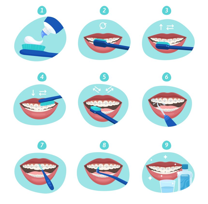 La Técnica de Cepillado en Tres Pasos: Guía Esencial Recomendada por Odontólogos Paraguayos para una Higiene Bucal Impecable
